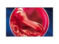 5 неделя беременности